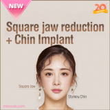 Square jaw reduction, cheekbone reduction and genioplasty